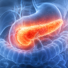 Acute Pancreatitis